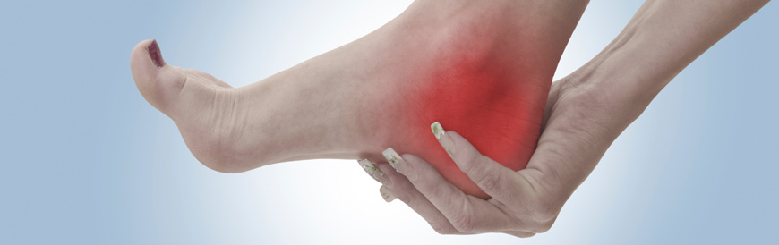 Plantar Fasciitis Physical Therapists in San Francisco
